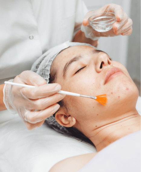 Medium Peels